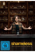 Shameless: Die Komplette Serie  [34 DVDs] DVD-Cover
